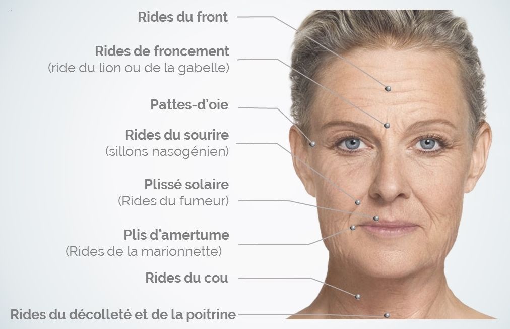 types de rides visage