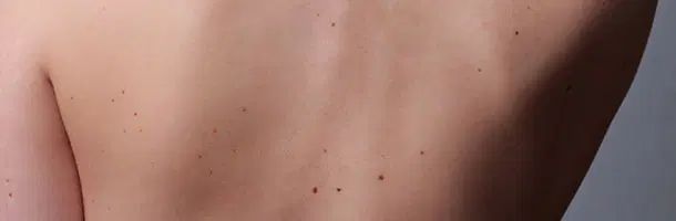 peau genève clinique du lac